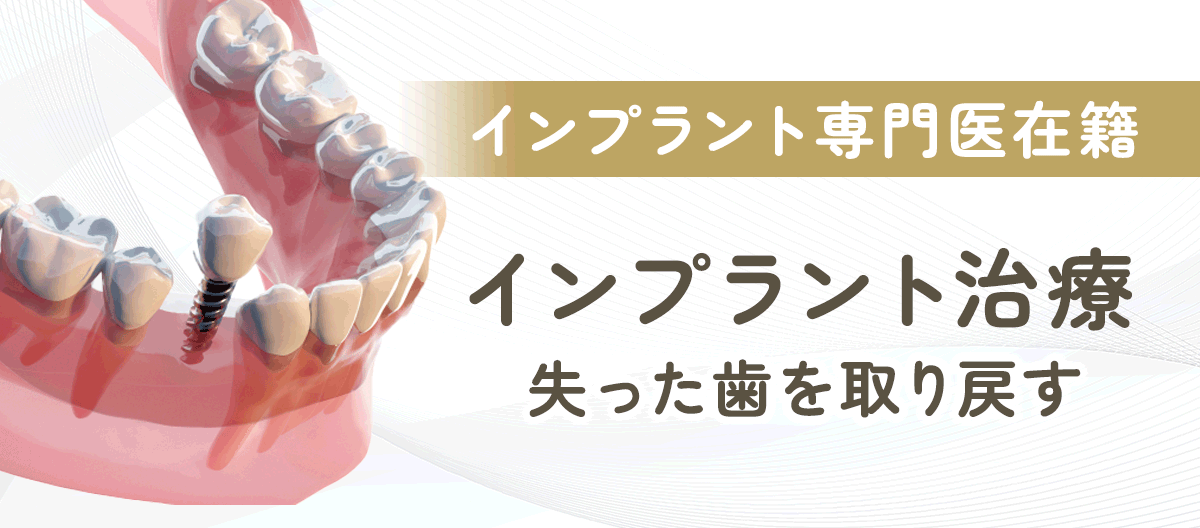 インプラント治療